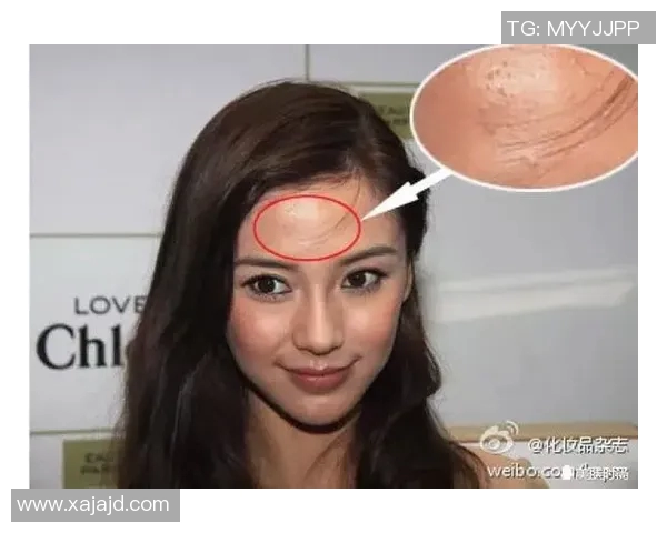 足球明星因压力与训练频繁面临痘痘困扰引发粉丝热议与关注